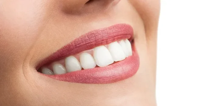 A Guide to Composite Bonding: London’s Solution for a Perfect Smile